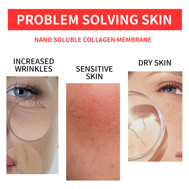 OmniFix® Melting Collagen Film
