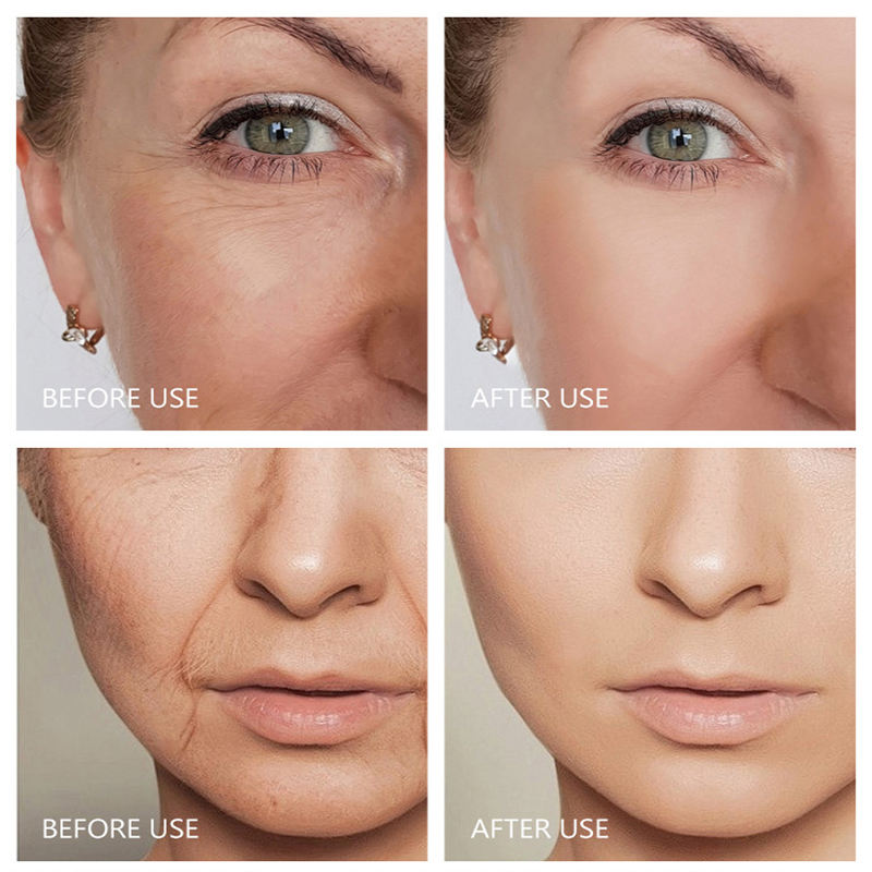 OmniFix® Melting Collagen Film