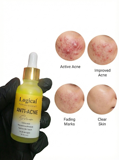 OmniFix® Logical Anti-acne Serum